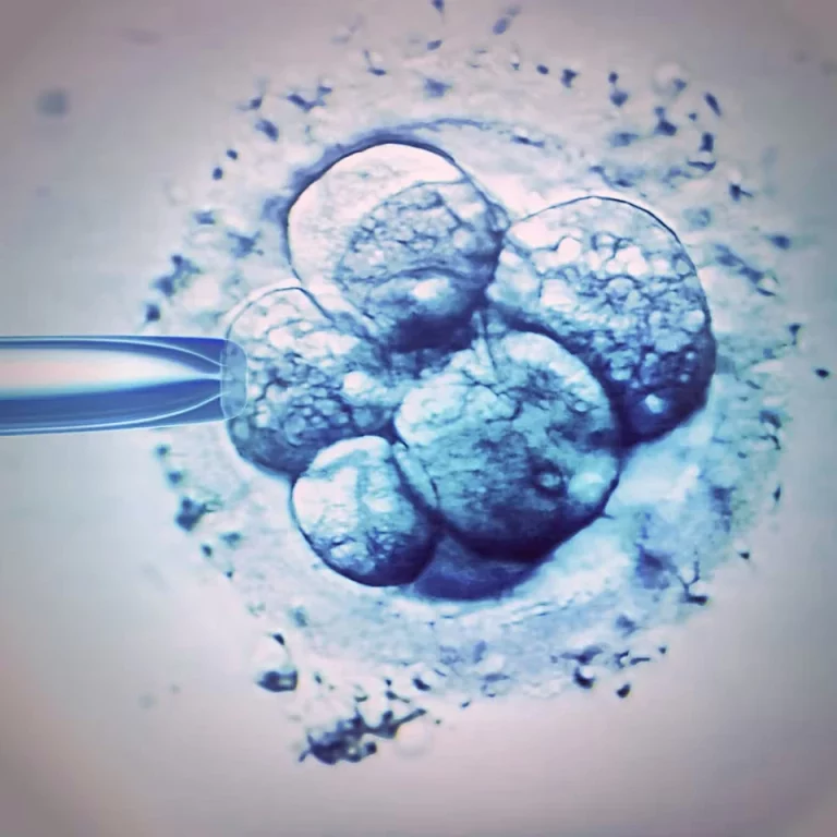 PGT Testing: What Is Preimplantation Genetic Testing In IVF?