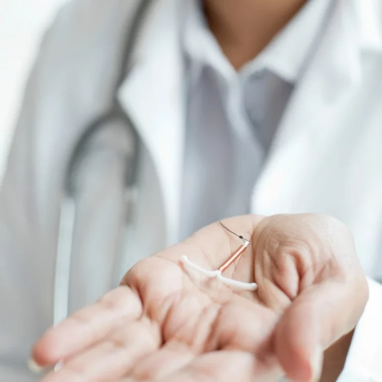 IUDs For Birth Control: 10 Questions Answered By An Expert Doctor