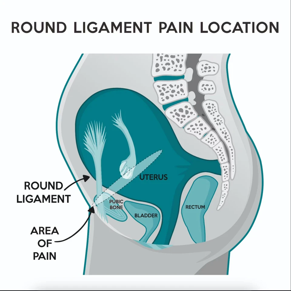 round-ligament-pain-in-pregnancy-femhealth-women-s-health-care