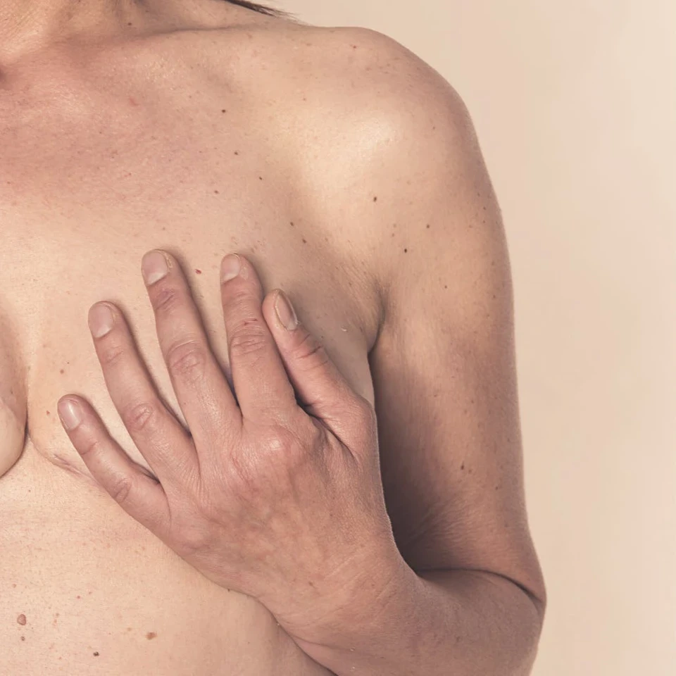 Breast+Cancer+Symptoms